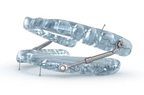 Sleep Apnea Treatment in Foley, AL | Enjoy Better Sleep Today