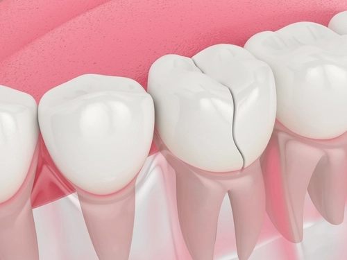 Urgent Dental Care in Foley, AL | Providing Comfort and Pain Relief