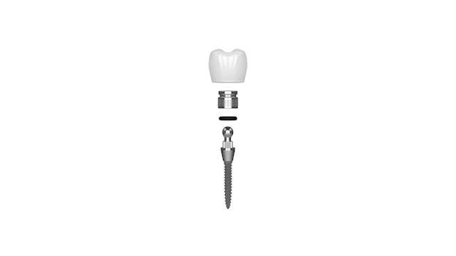 Teeth In A Day in Foley, AL | Mini Dental Implant Solutions