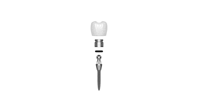 Same-Day Dental Implants in Foley, AL | Mini Dental Implants