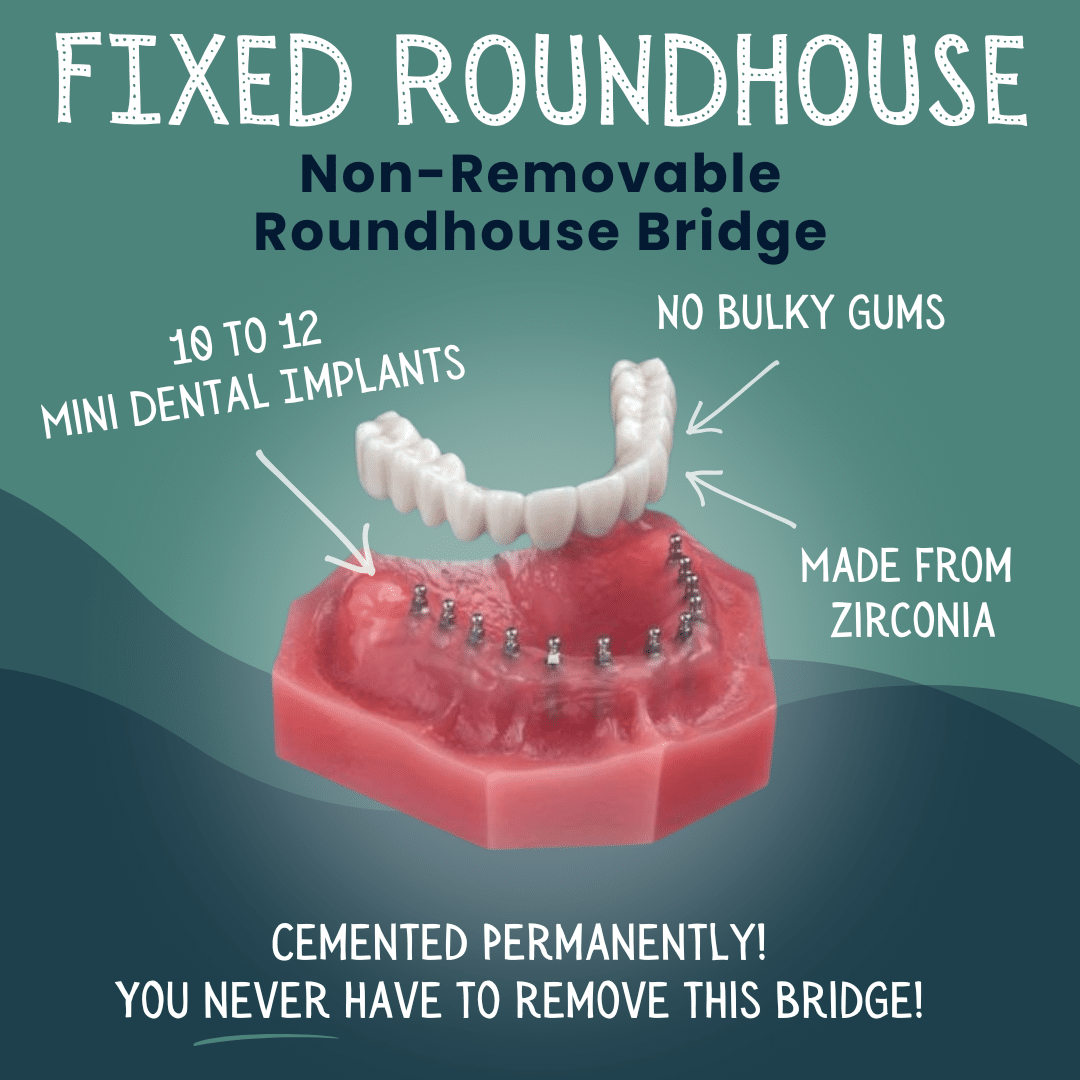 Fixed Roundhouse Bridge in Foley, AL - Riviera Dental Care