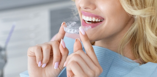 Braces Alternatives in Foley, AL | ClearCorrect Solutions