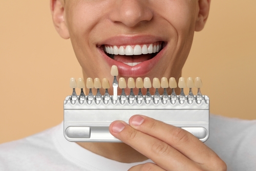Smile Makeover in Foley, AL | Dental Veneers Revitalize Your Smile