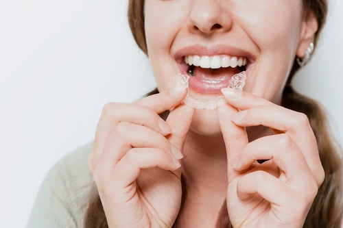 ClearCorrect in Foley, AL | Affordable Orthodontics Near Me