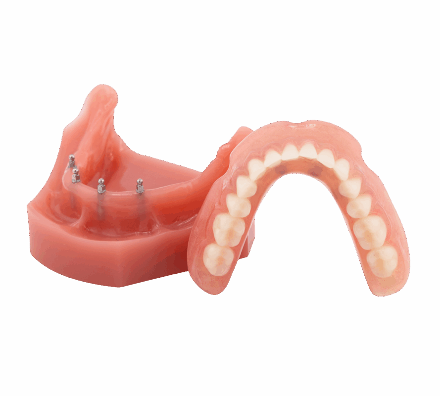 Snap-In Dentures in Foley, AL | Book a Free Implant Consultation