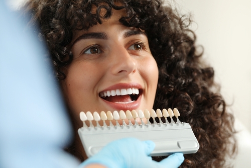 What Is the Veneers Process | Revitalize Your Smile in Foley, AL