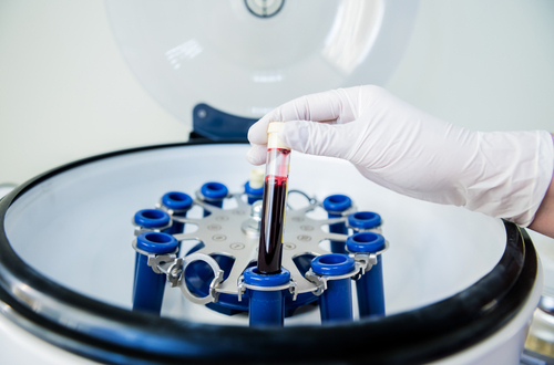 Regenerative Medicine in Foley, AL [Video Demo] L-PRF Treatment