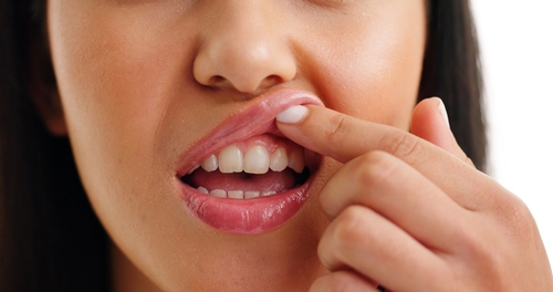 Reverse Gum Disease [Video Q&A] Keep Your Smile Healthy in AL