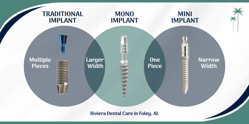 Types of Dental Implants [Video Walkthrough] | Mini vs Mono vs Traditional Implants