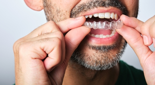 Invisalign Dentist in Foley, AL | Clear Aligner Treatment Near Me